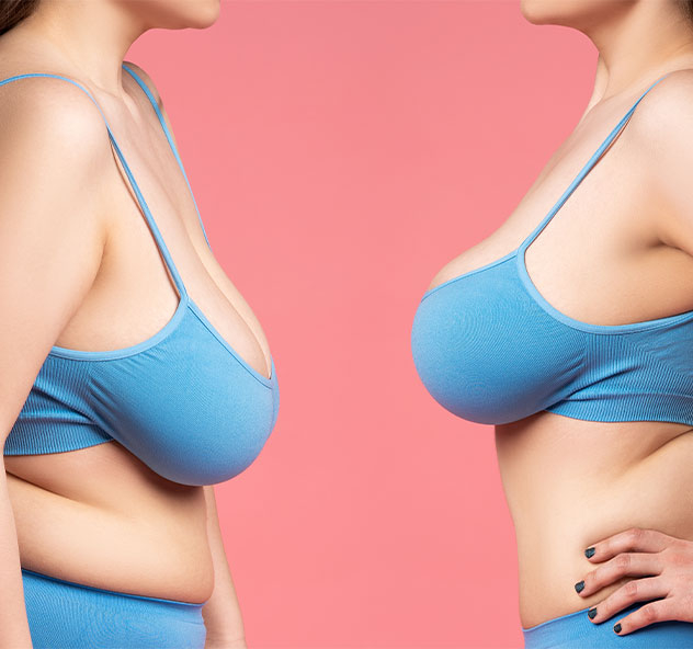 Frequently Asked Questions About Breast Reduction Surgery